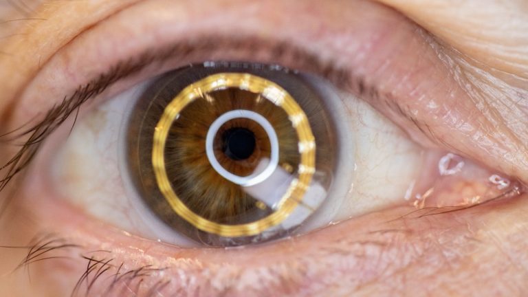 Contact lens drug delivery