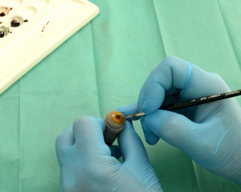 Hand painted prosthetic contact lenses